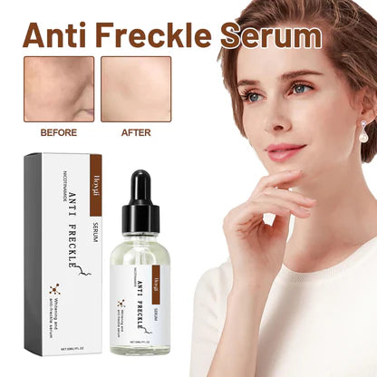 Anti Freckle Serum Skin Dark Repair [30ml]
